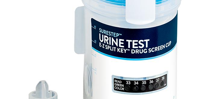 what does a split urine test test for what does a split urine test test for